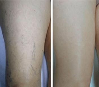 Dr. Raúl Bacelis Arzápalo