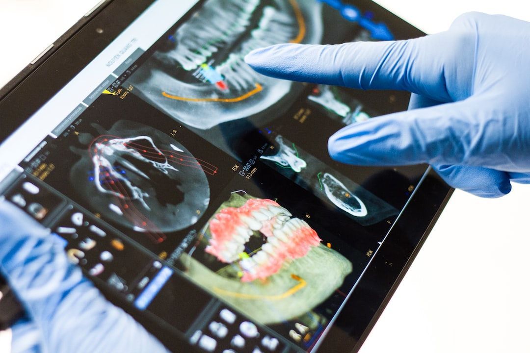 Smart View Pad for Digital Dentistry