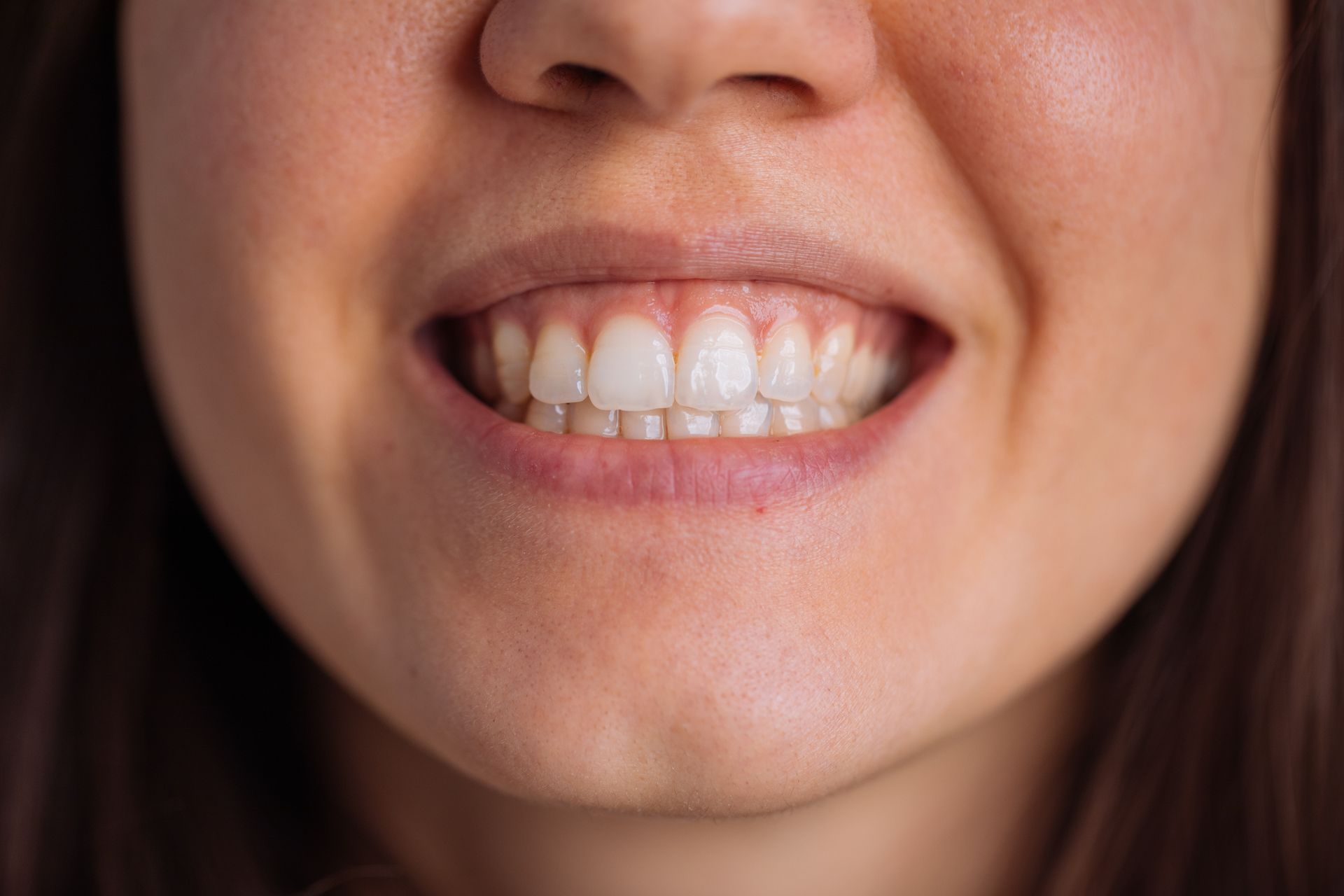 Smiling woman's mouth, showing straight, white teeth. Lips are slightly parted. Close-up shot.
