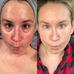 A before and after photo of a woman 's face with a towel on her head.