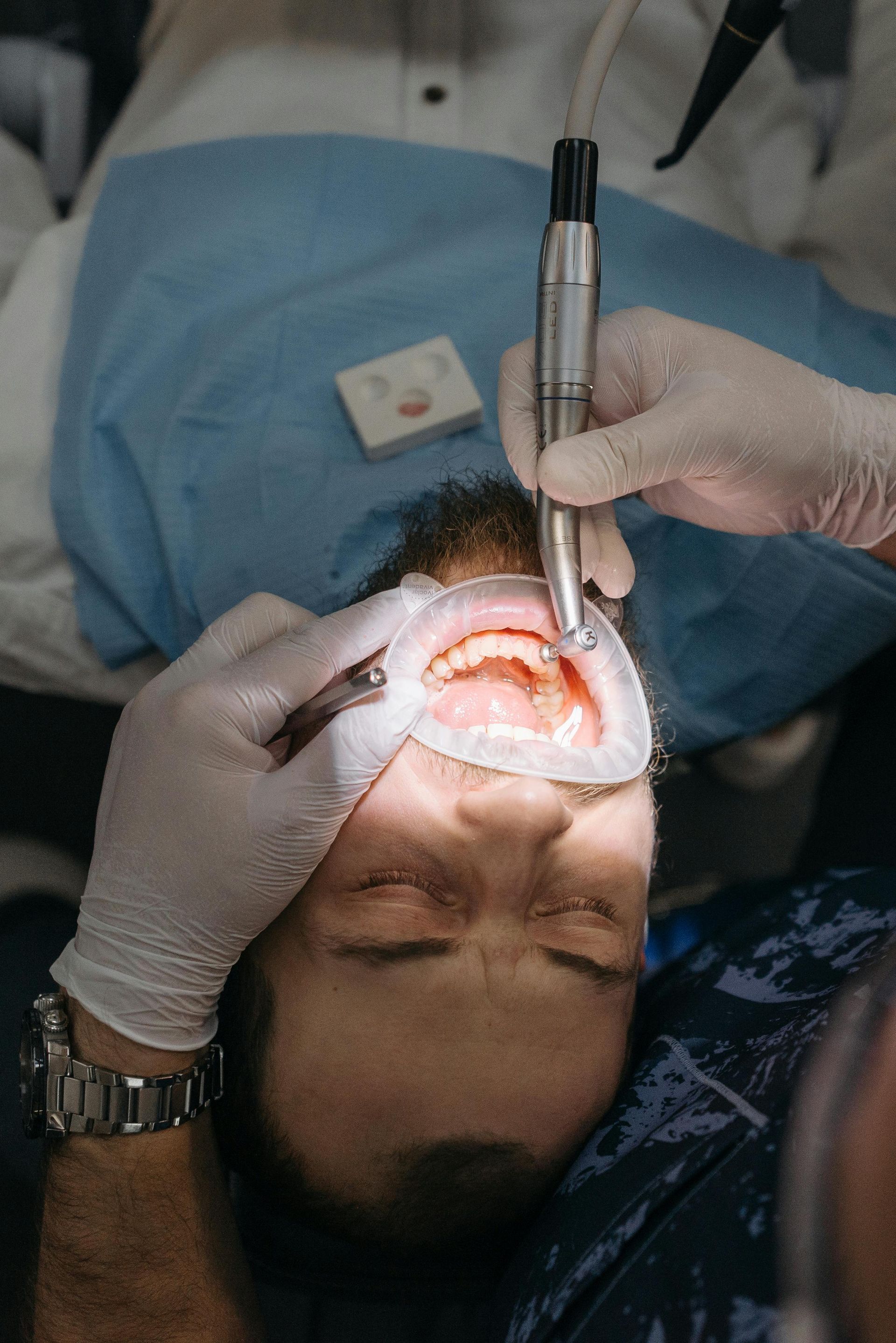 Person fitting clear aligners onto teeth with fingers