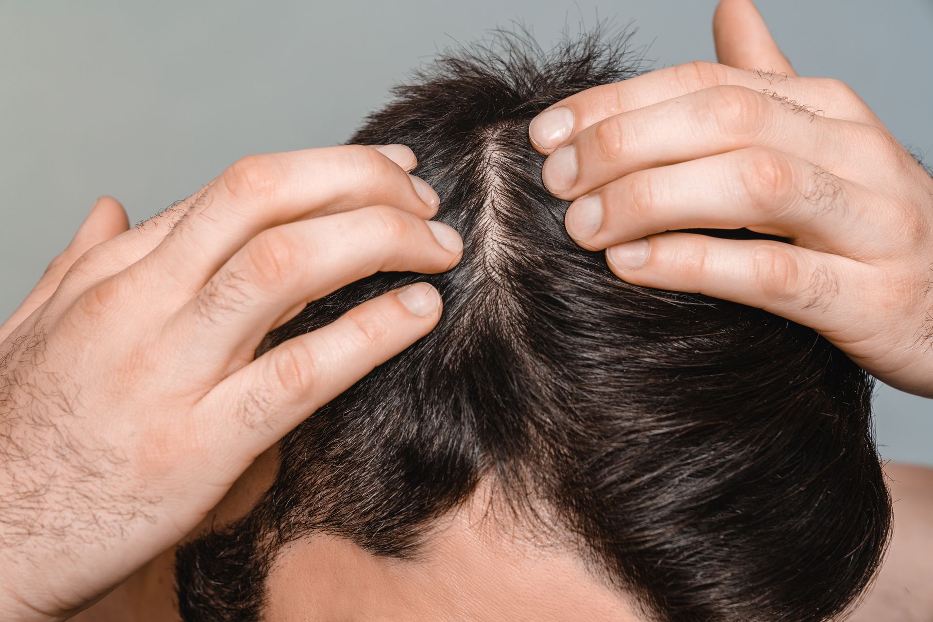 Person's hands examining thinning dark hair on scalp, close-up view.