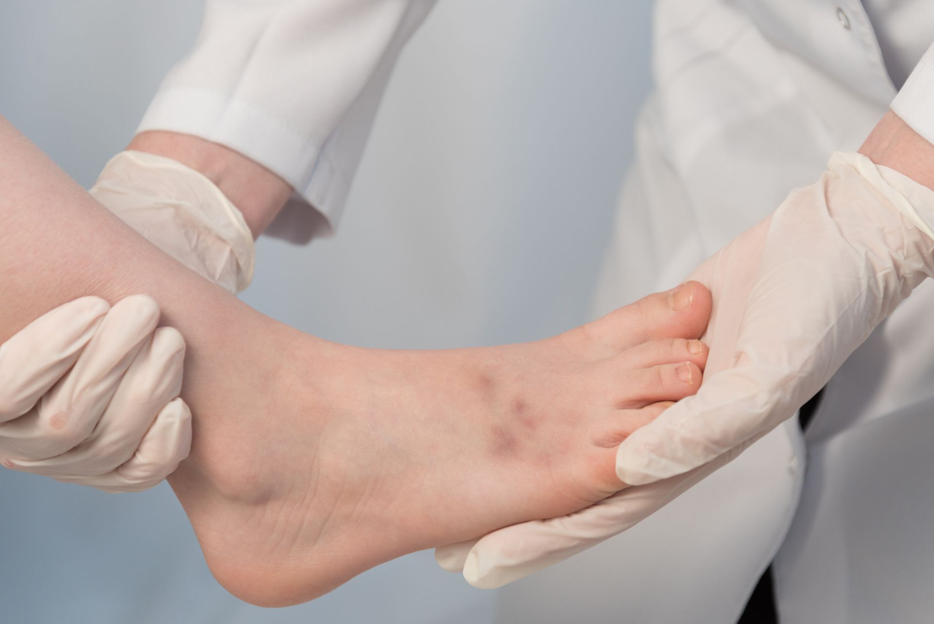 Diabetic Foot Conditions — Ellenbrook, WA — Ellenbrook Foot Clinic