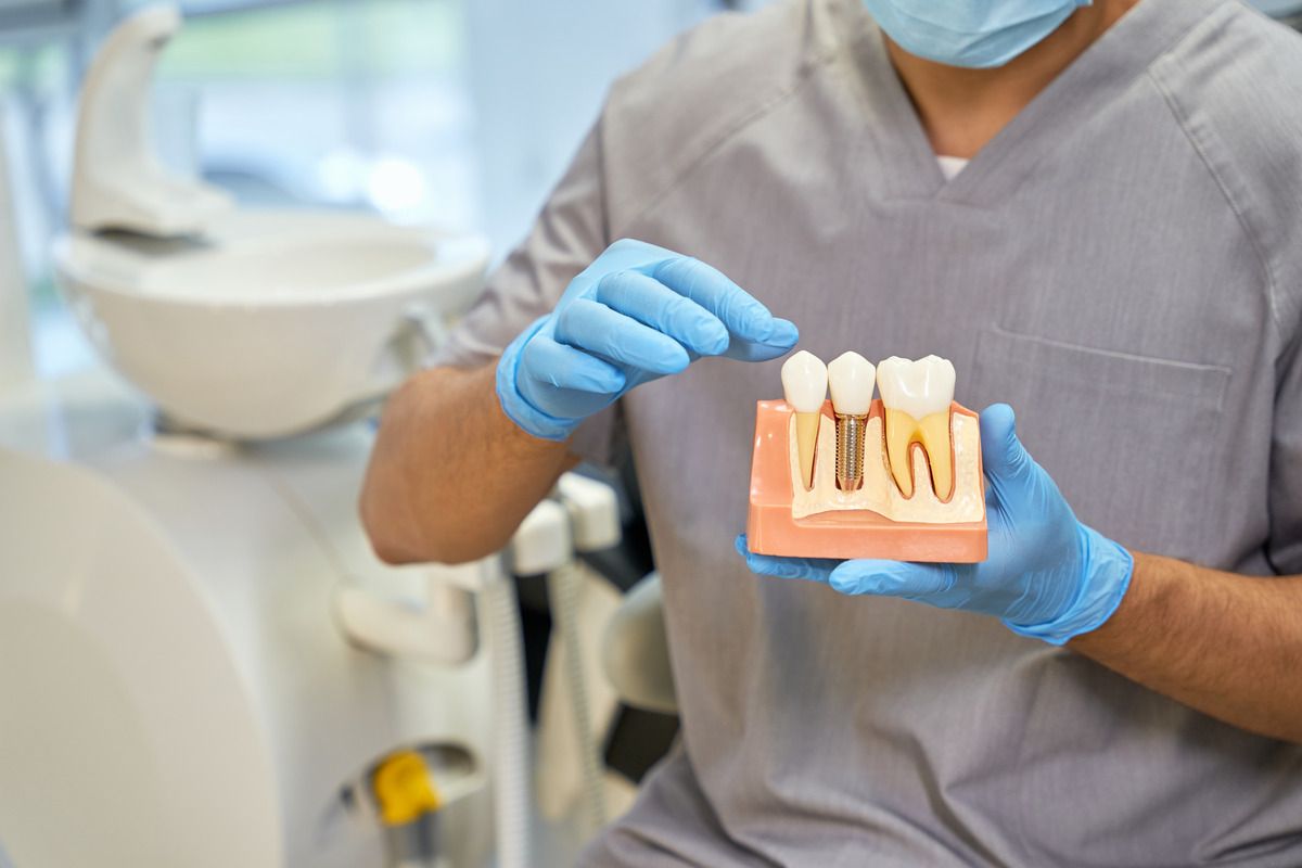 Dentist holding dental implants | Family Dentist in S. Burlington, VT