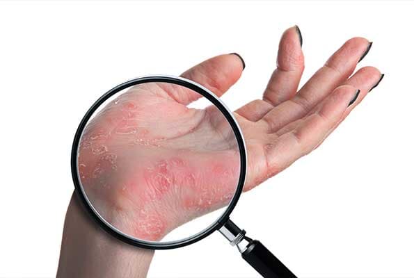 DRA. LORENA DE LA CRUZ LÓPEZ