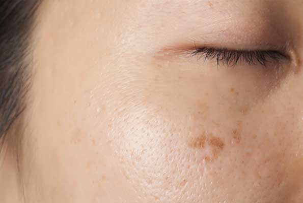 DRA. LORENA DE LA CRUZ LÓPEZ