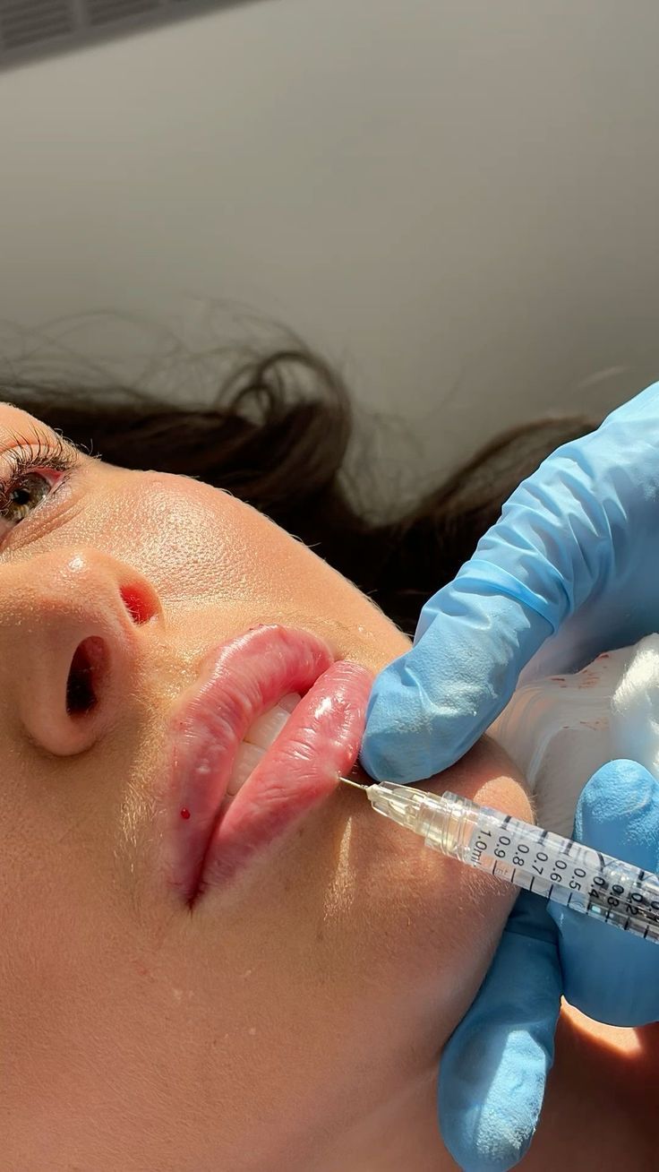 Woman receiving dermal filler injection to her jaw, being held by gloved hands.