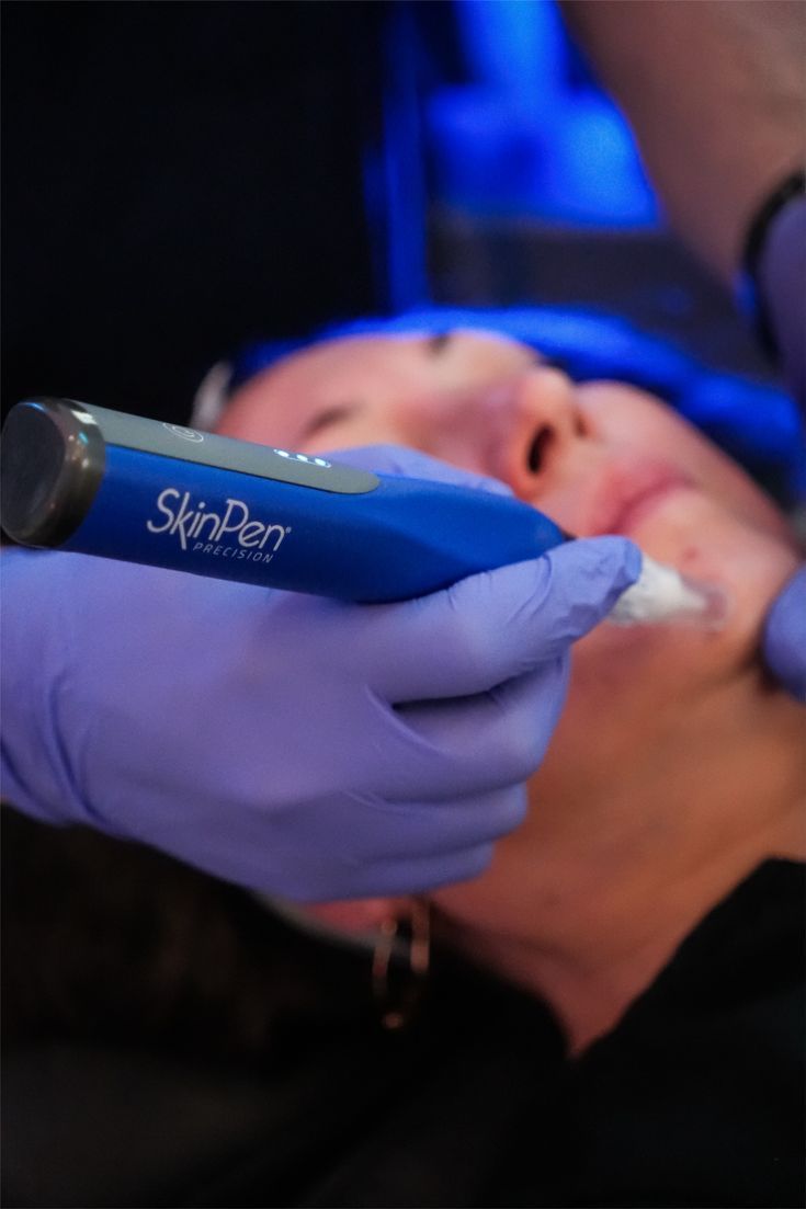 SkinPen microneedling collagen induction therapy in Pensacola Florida