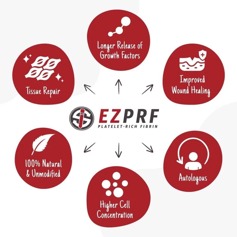 Diagram of EZPRF benefits: tissue repair, growth factors, wound healing, autologous, higher cell concentration, natural.