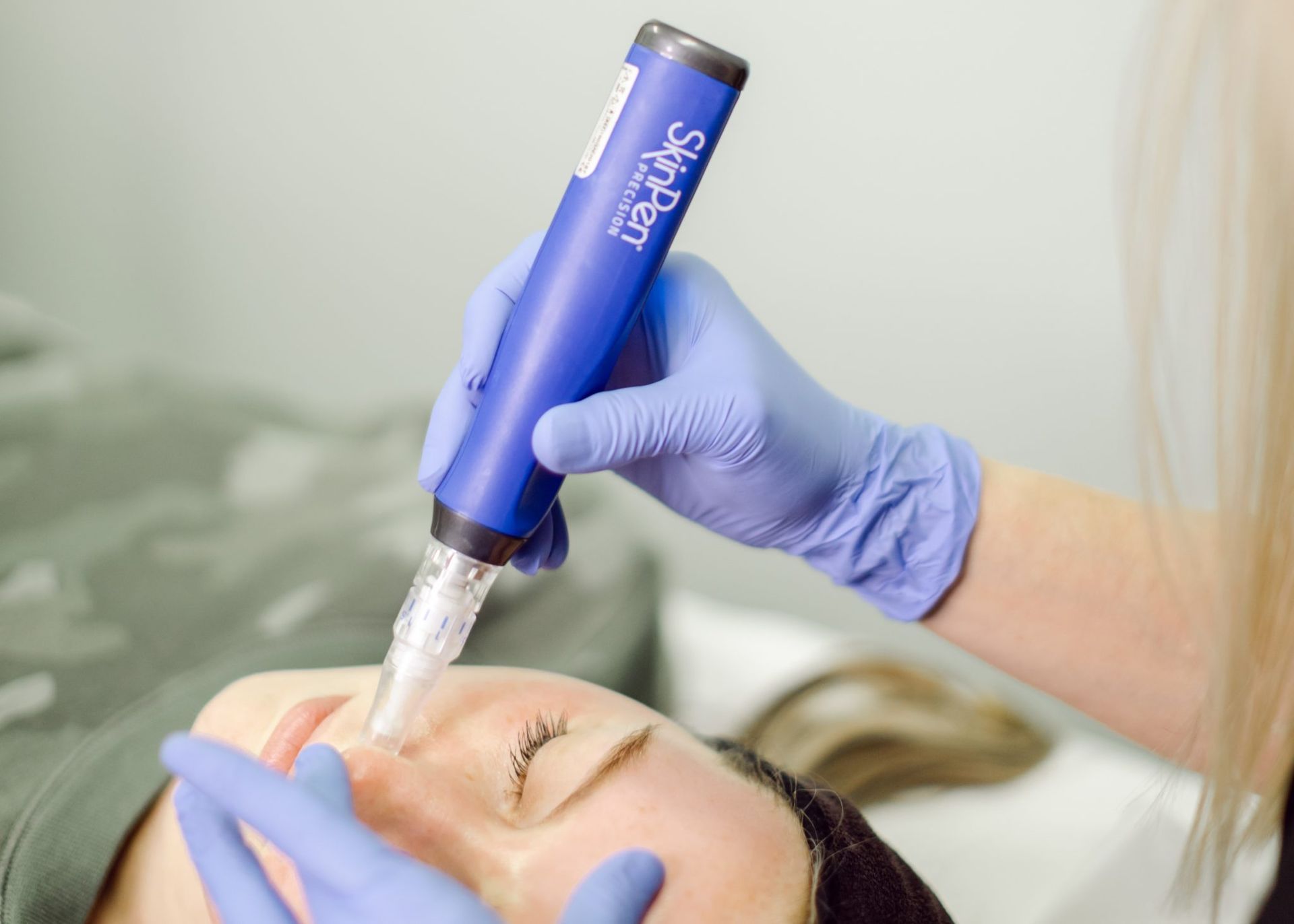 Person receiving a facial treatment; SkinPen microneedling treatment 