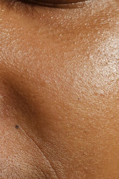 A handheld microneedling device positioned near a person's cheek for a cosmetic skin treatment.