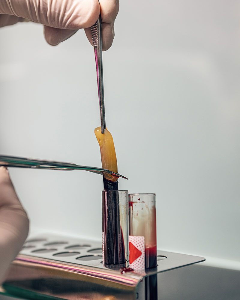 A gloved hand holds a tissue sample with tweezers, cutting it over a blood-filled test tube rack.