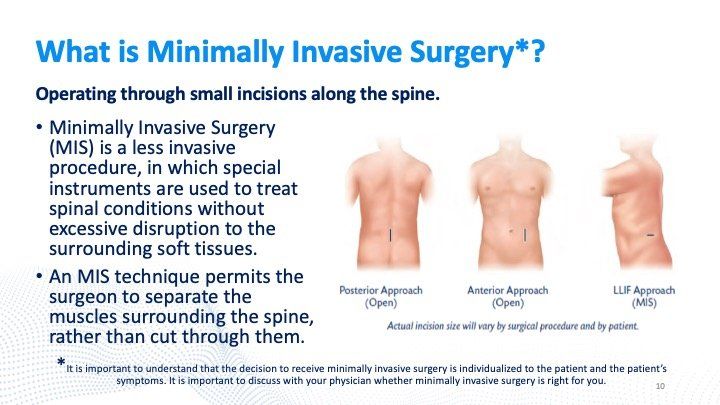 minimally-invasive-surgery-slide