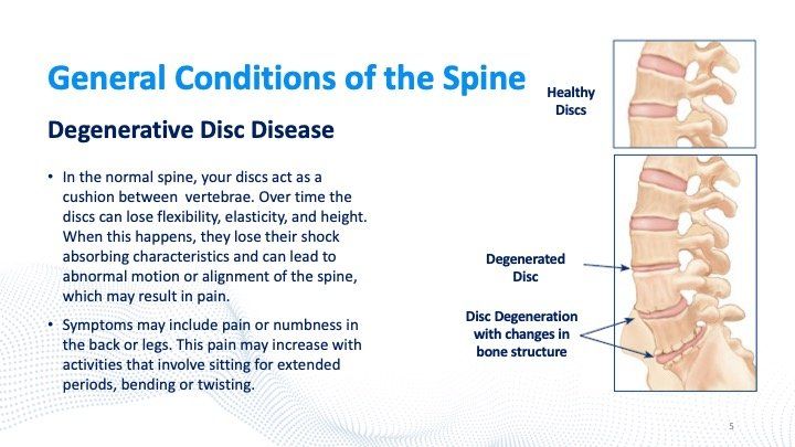 general-conditions-of-the-spine-slide