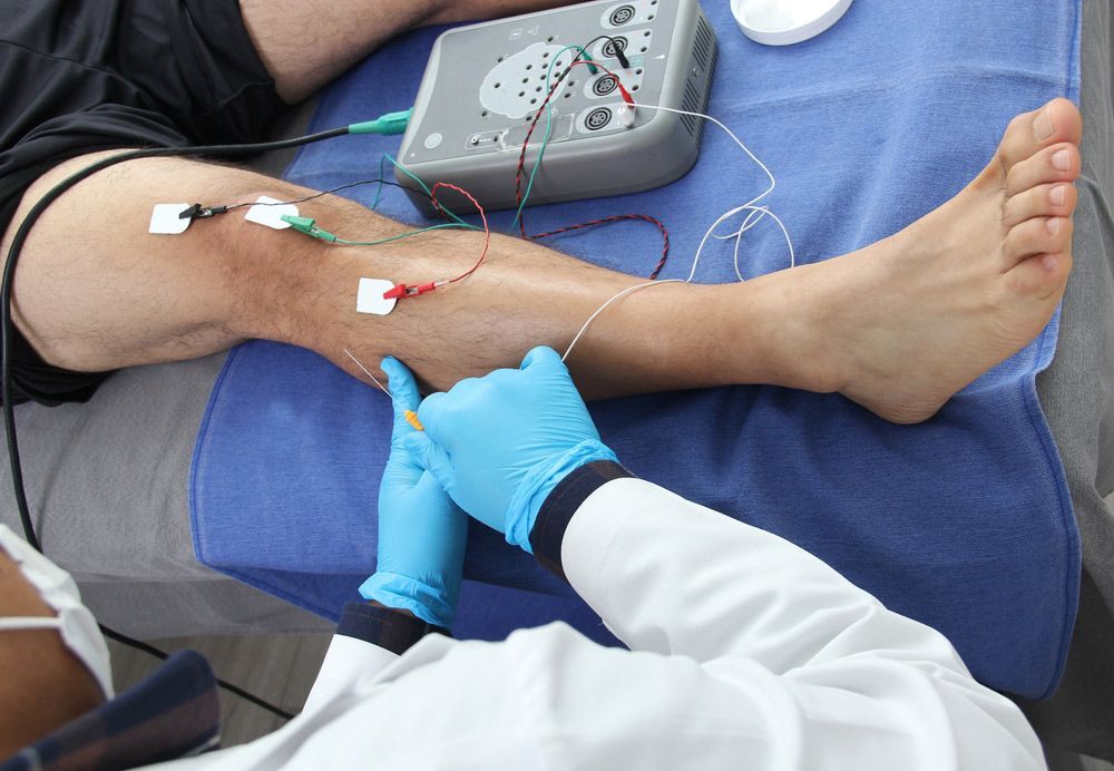 A Person Is Getting Electrodes Applied To Their Leg — Caves Coastal Physiotherapy in Murrays Beach, NSW