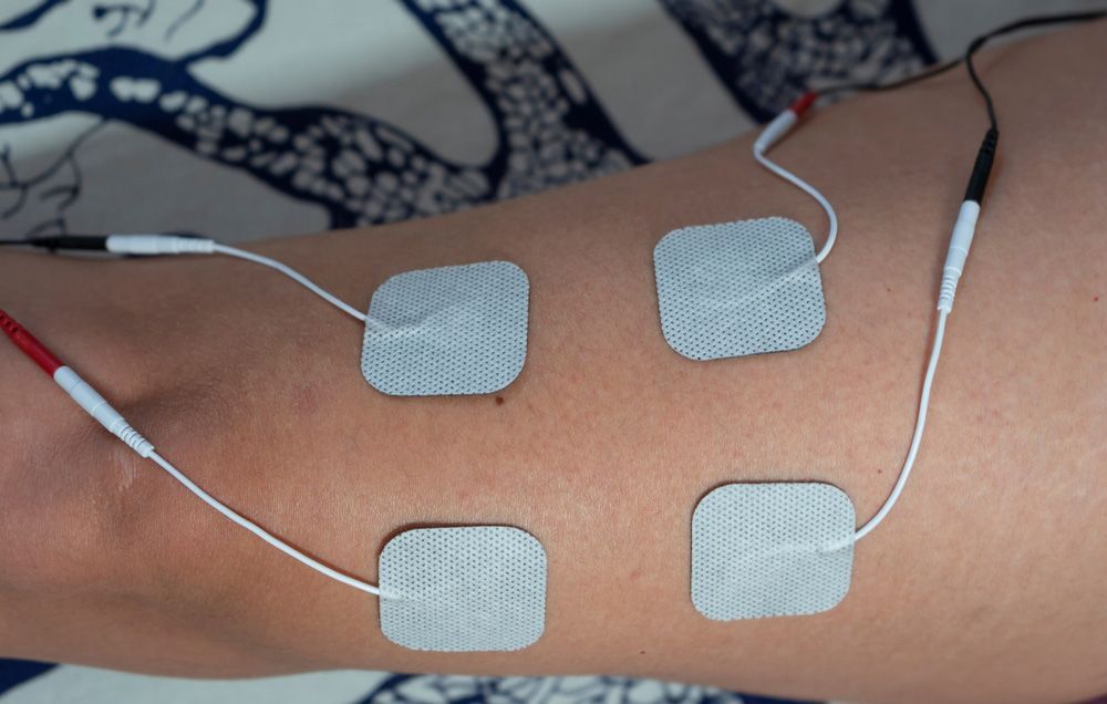 A Person Is Laying On A Bed With Electrodes On Their Arm — Caves Coastal Physiotherapy in Caves Beach, NSW