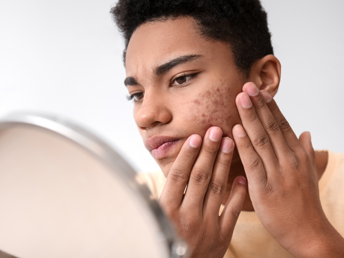 a young man is looking at his face in a mirror .