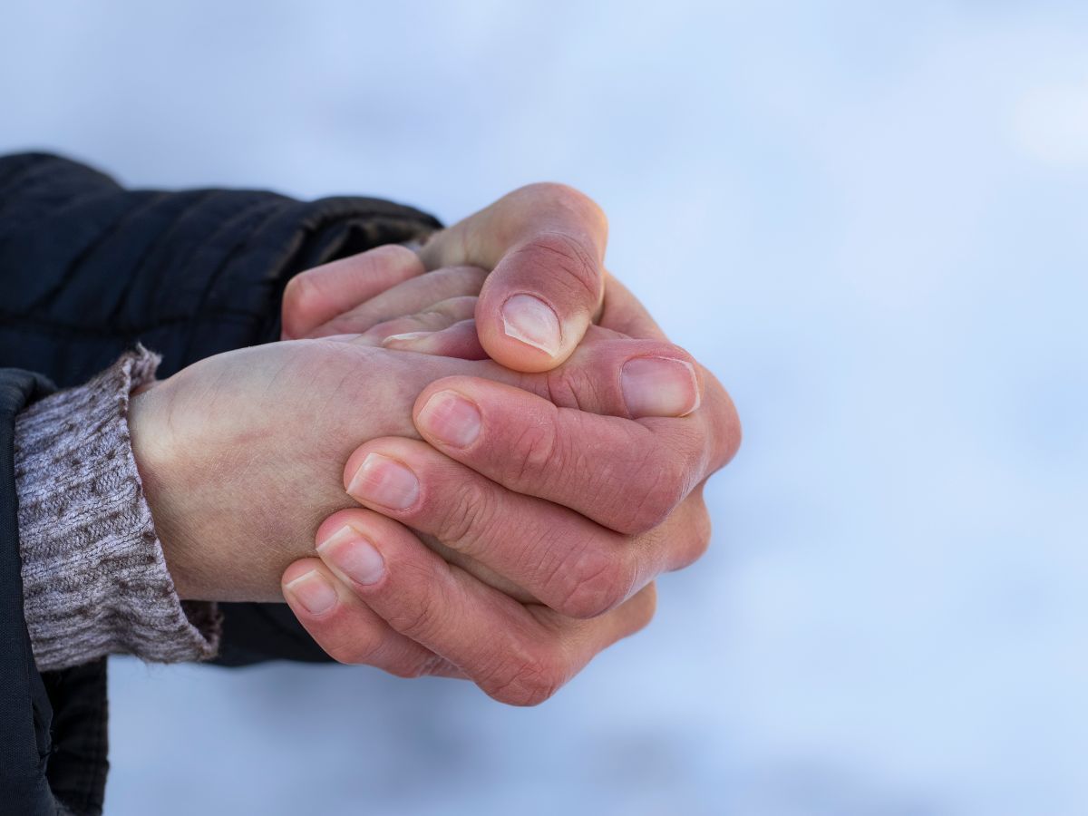 Allow Nourishment / wind burn on hands from the cold weather