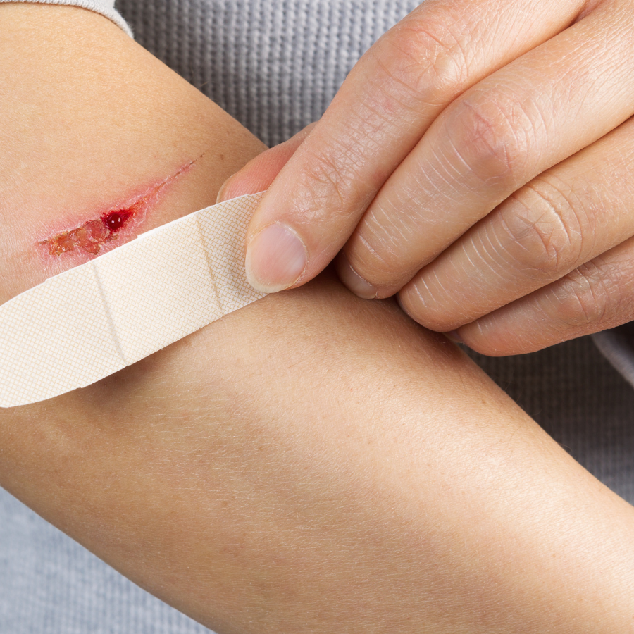 Allow Nourishment / A person is putting a bandage on their arm that has a small cut.