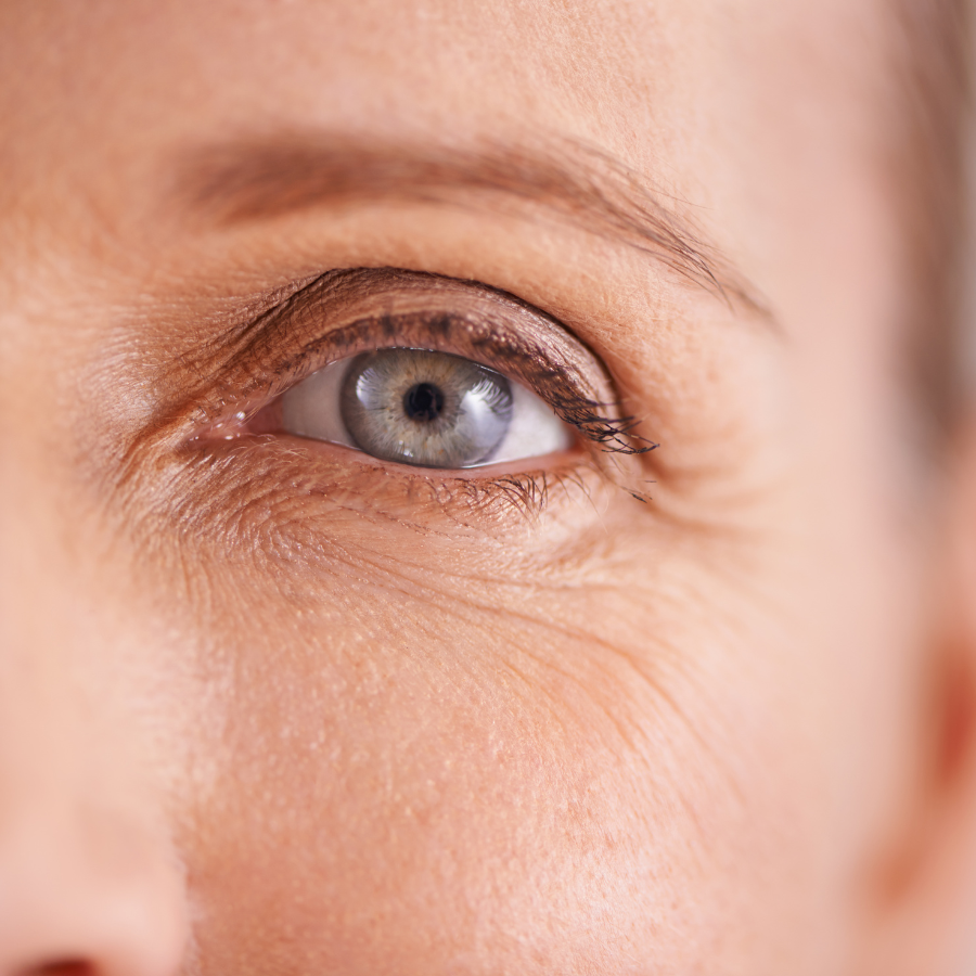 Allow Nourishment / A close-up of a woman's blue eye with wrinkles.