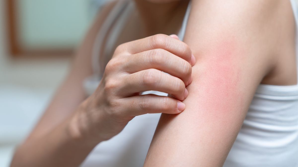 A woman is scratching her arm with her hand.