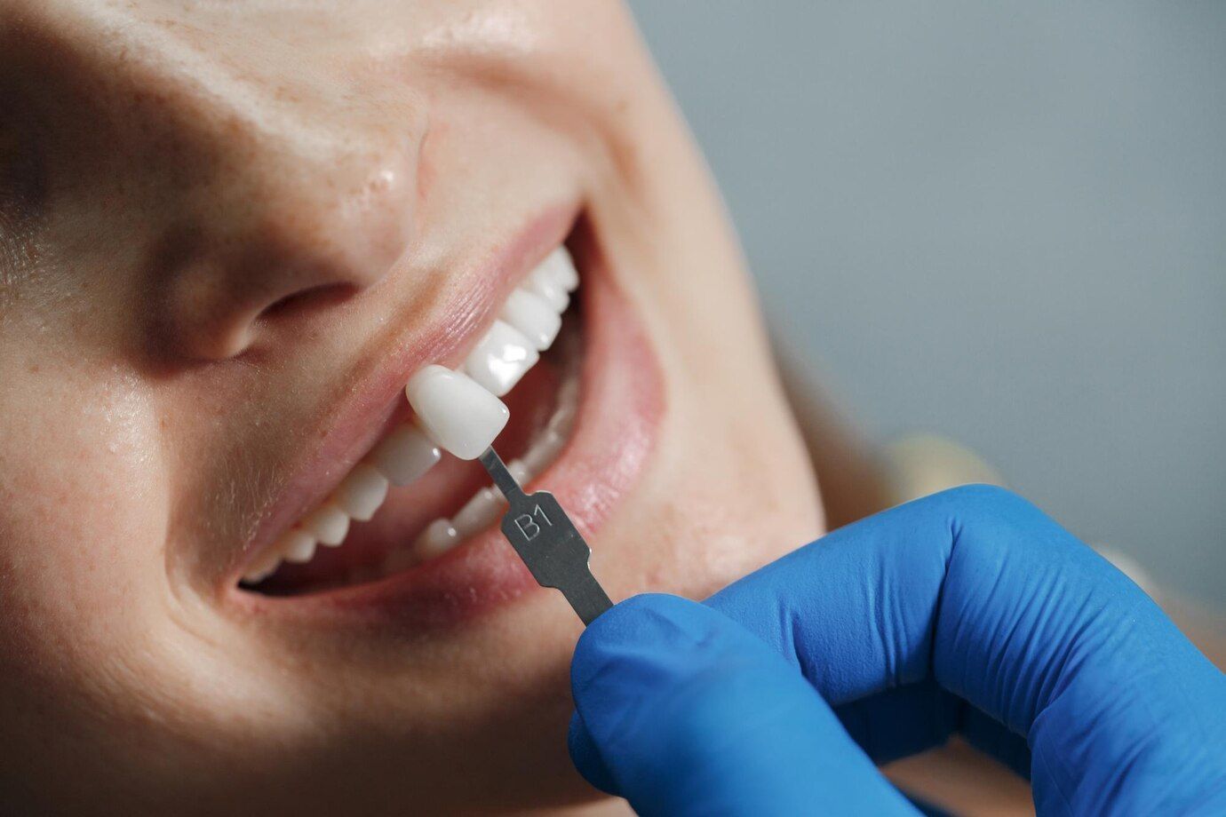 A close up of a person 's teeth being examined by a dentist.