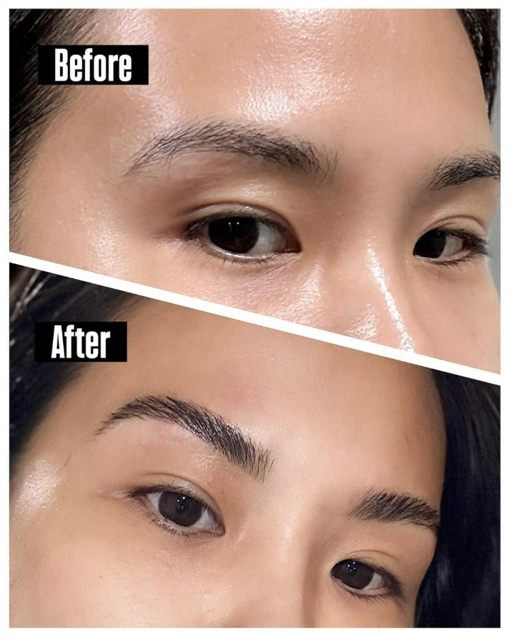 Before-and-after of eyebrows. Top: Sparse brows. Bottom: Fuller, shaped eyebrows after a beauty treatment.