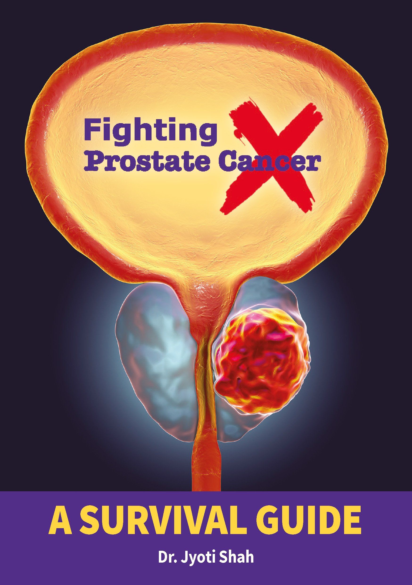Fighting Prostate Cancer –A Survival Guide