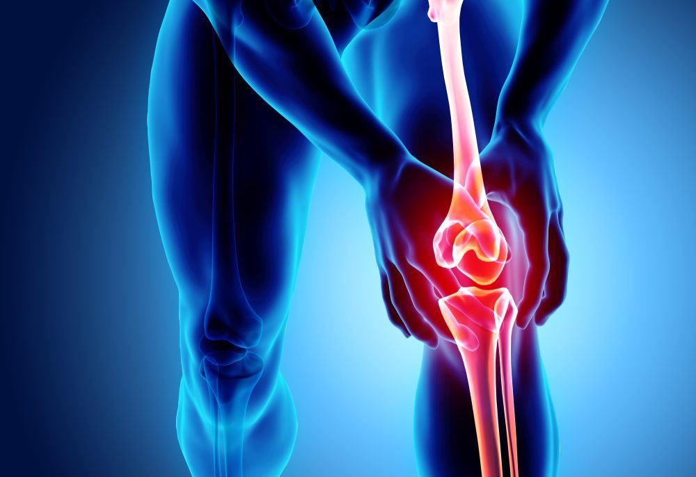 Skeleton Xray - painfull knee — Back Pain in Newcastle