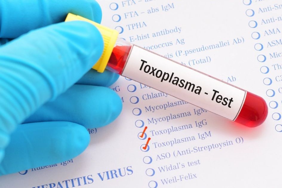 Test toxoplasma