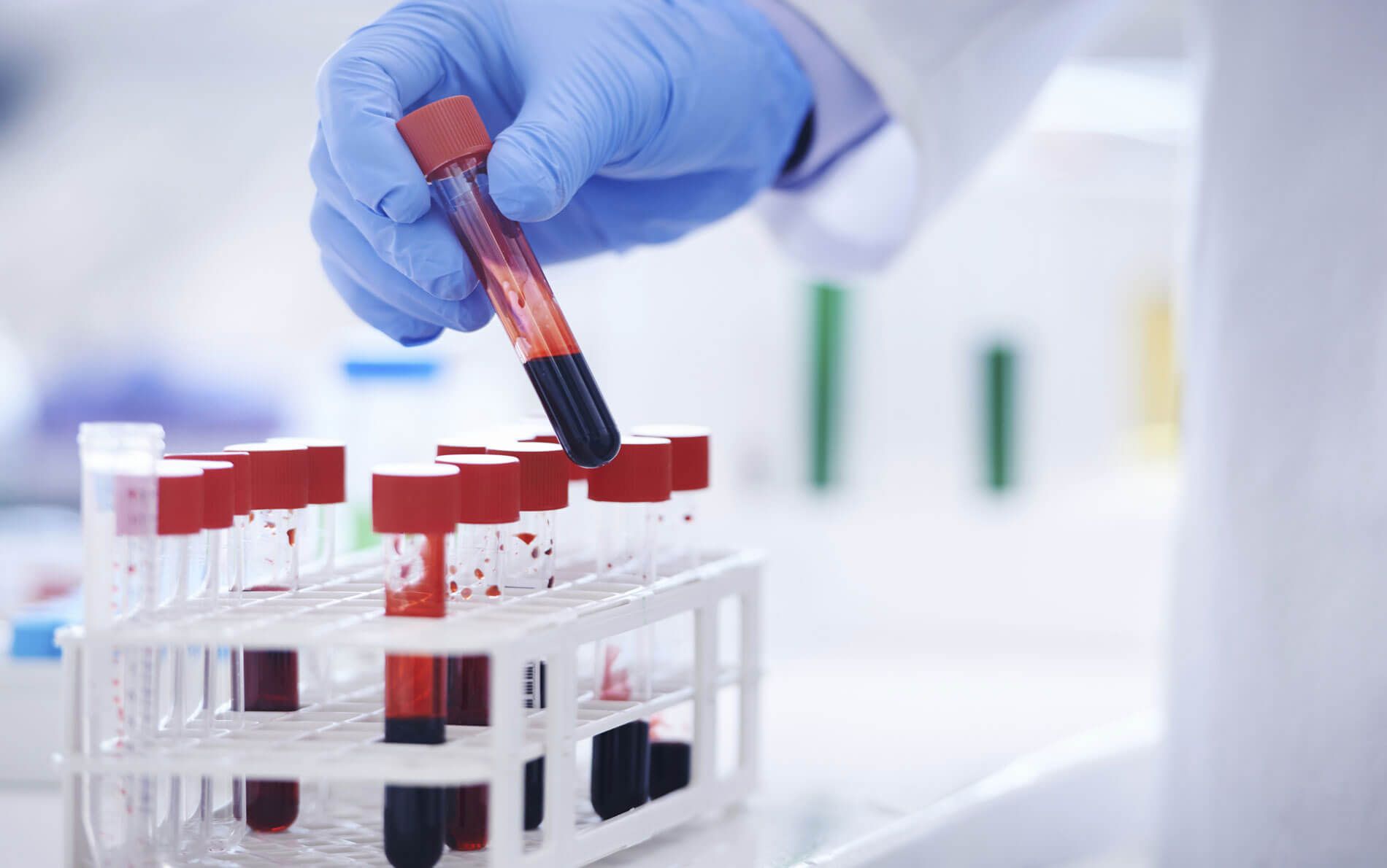 PRUEBAS DE PATERNIDAD