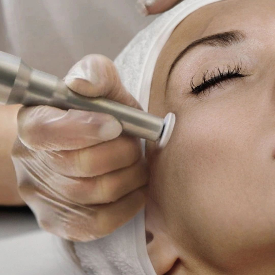 A close up of a woman getting a treatment on her face