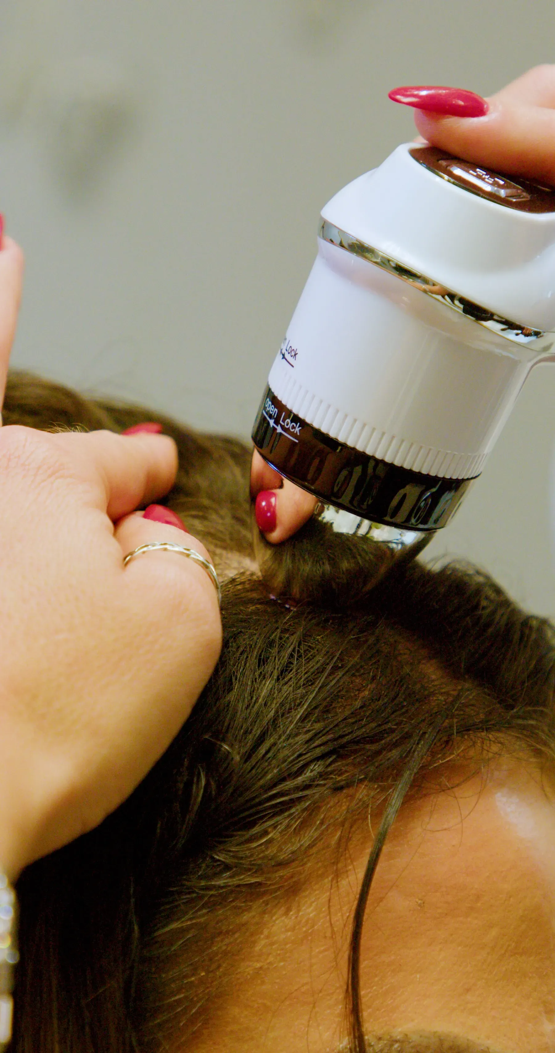 A person's scalp being examined with a white handheld device, likely a medical instrument, by someone with red nail polish.