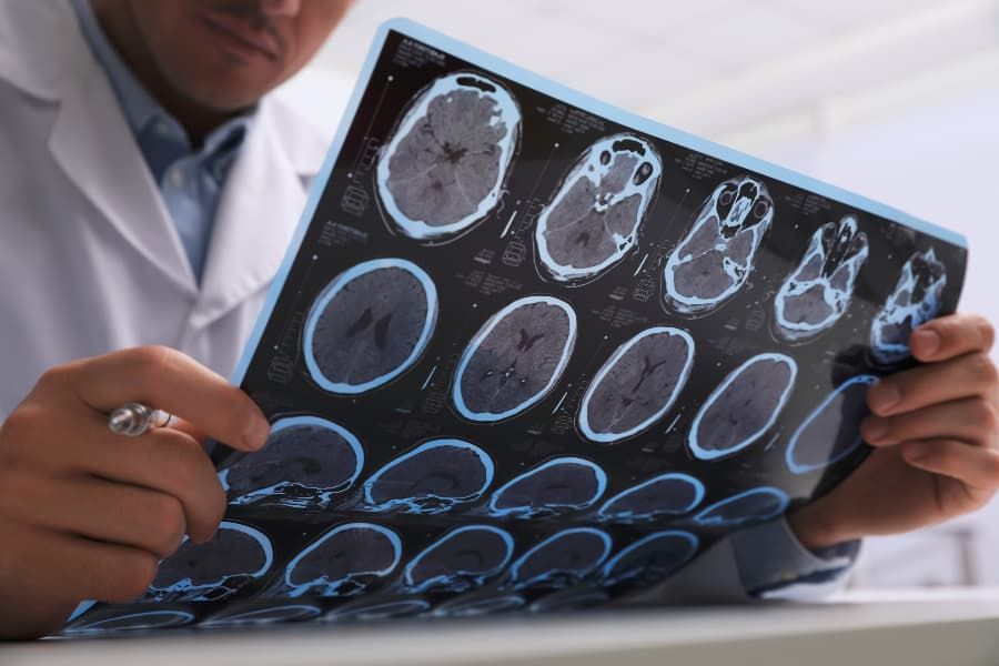 Doctor examining MRI images of a brain injury