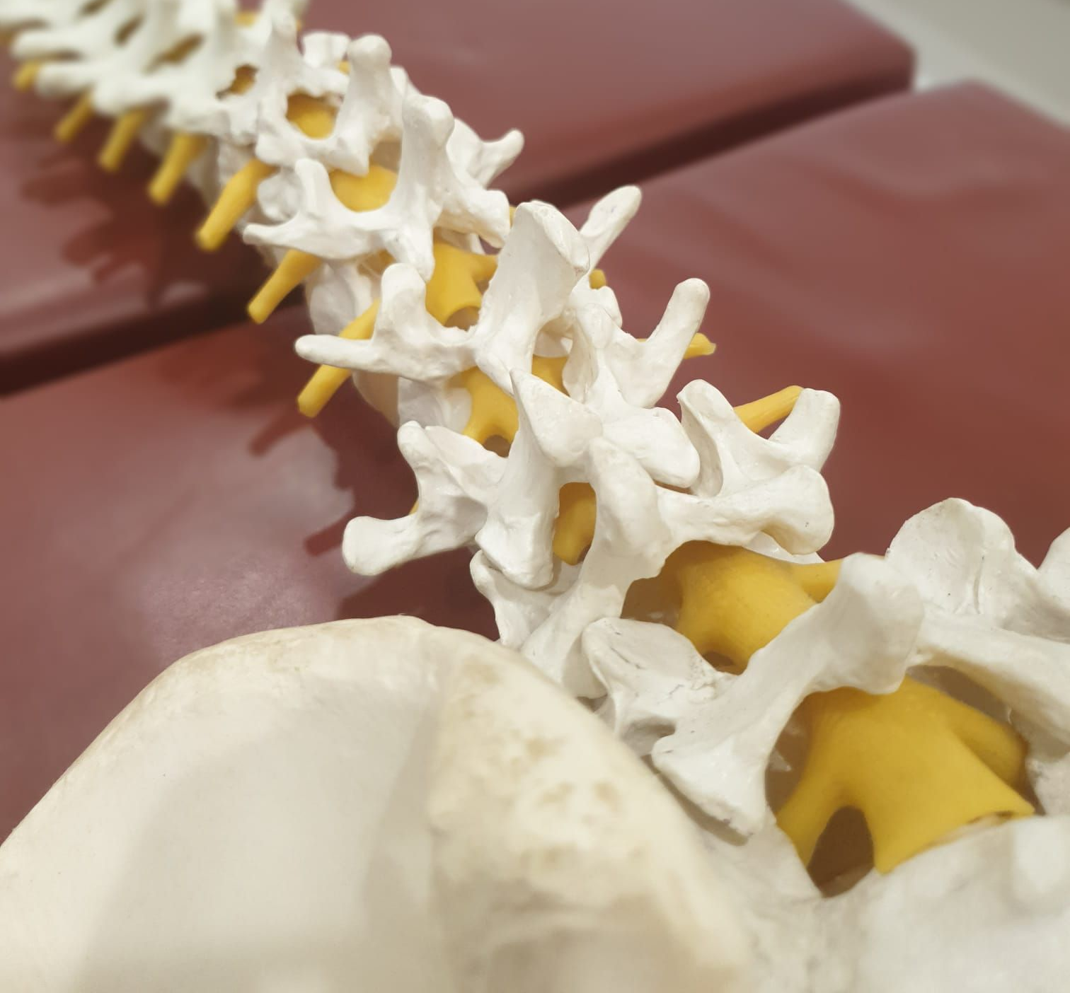 Chiropractic VS Painkillers Neck Pain Treatment Adelaide