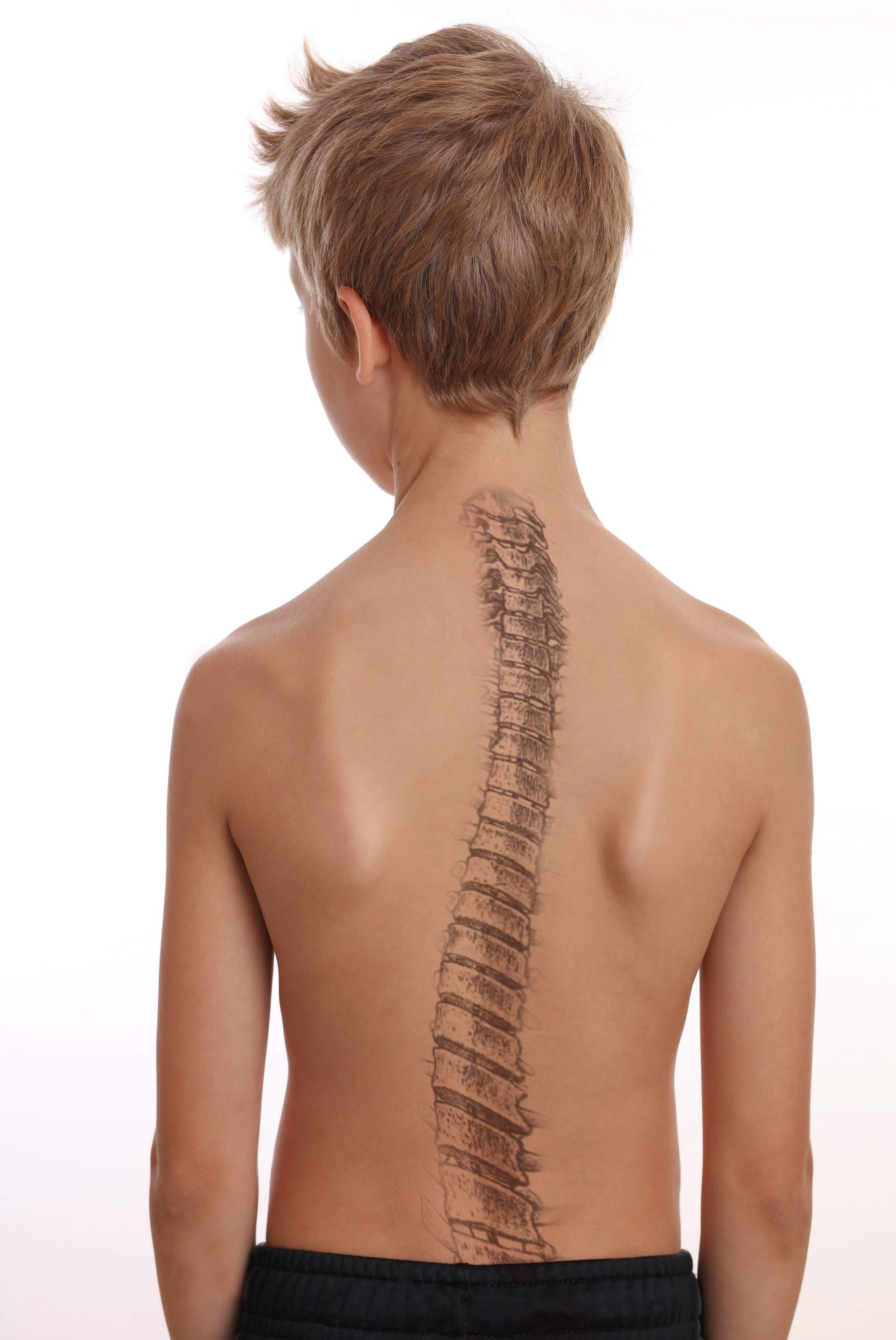 Chiropractic Treatment For Scoliosis In Childhood Adelaide