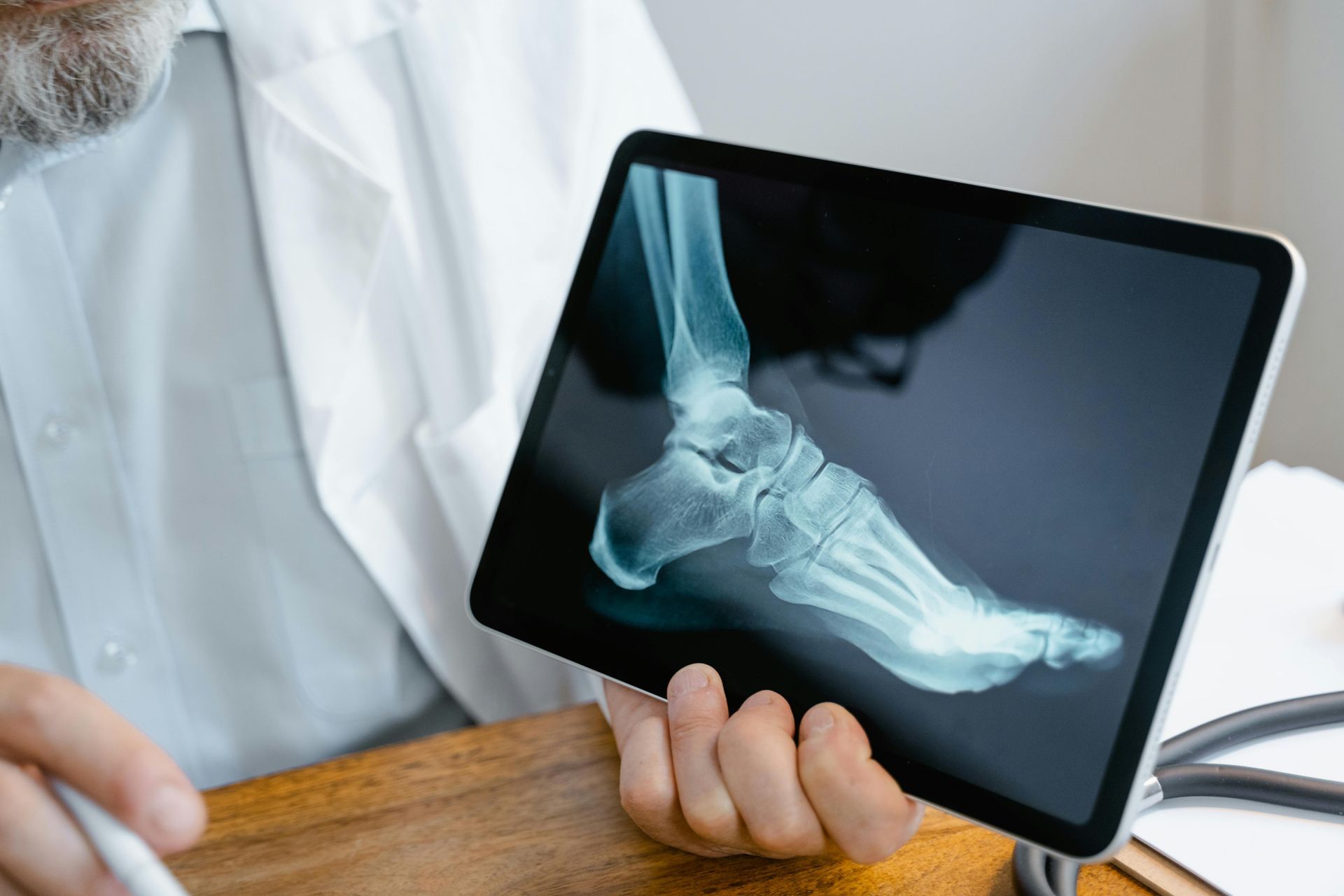 Causes And Treatment Of Ankle Fracture Pain In Adelaide