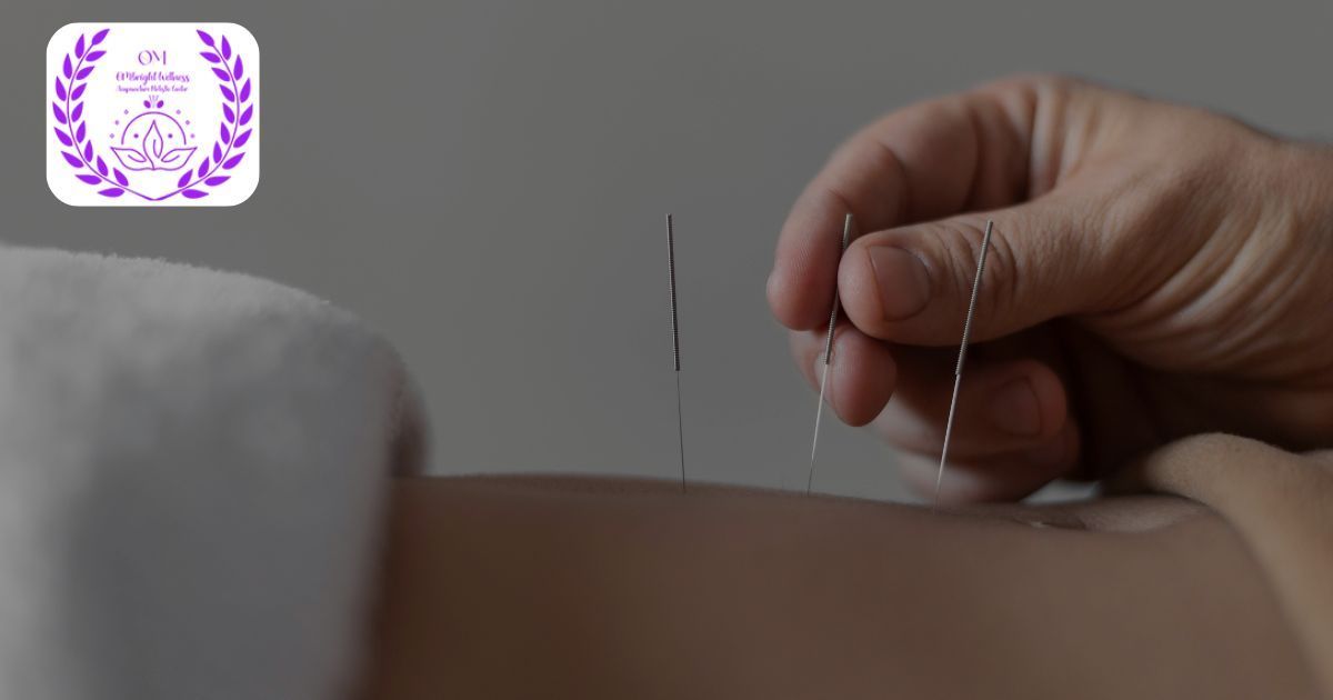 Coral Gables acupuncture