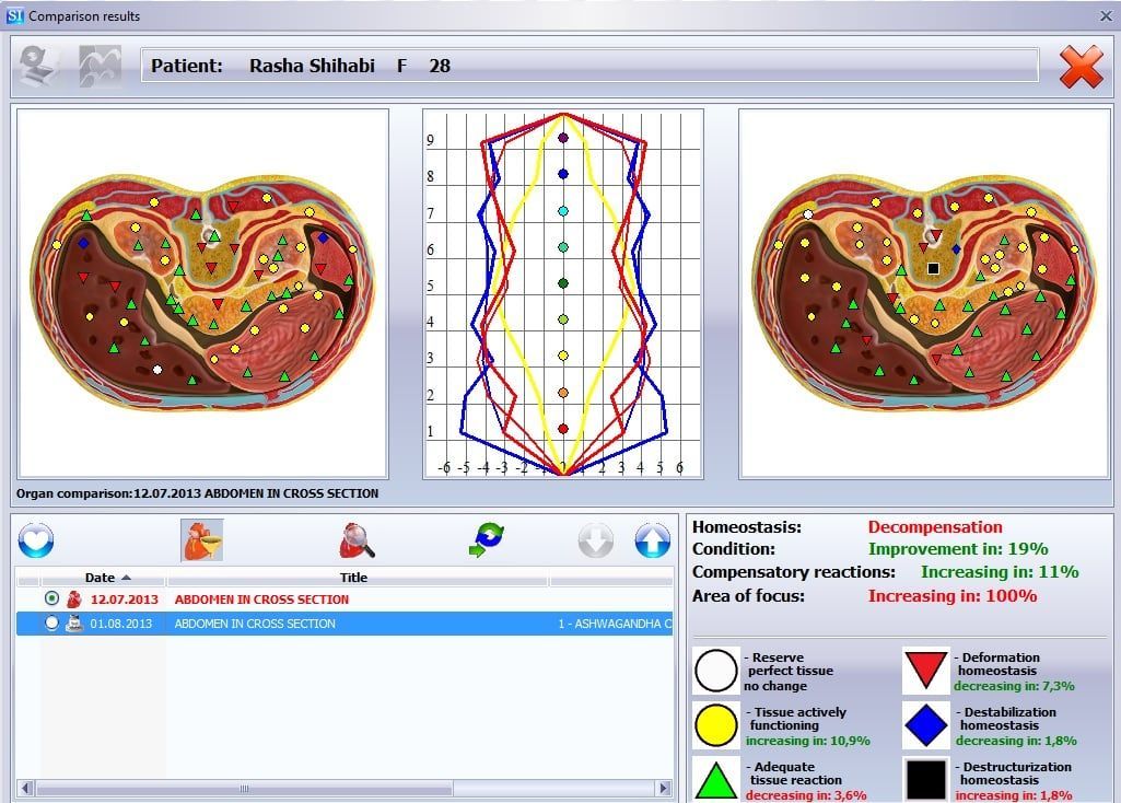 Screenshot of a medical software interface, showing graphical body scans, charts, and analysis data.