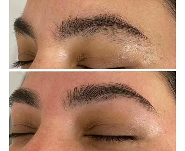 Woman Having Professional FAcial— Erikka's All Occasion Beauty In Rockhampton City QLD