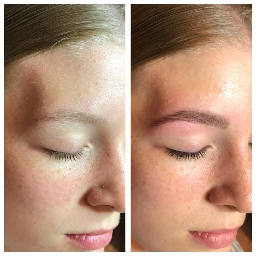 Beautician Doing Facial Led Light Therapy — Erikka's All Occasion Beauty In Rockhampton City QLD