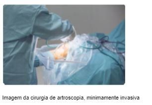 artroscopia-artrose-joelho-dr-diego-munhoz-ortopedista-especialista-cirurgia-joelho-sao-paulo