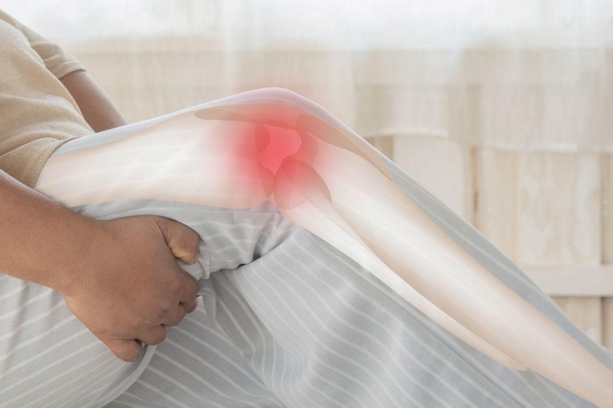 Artrose no joelho avançada: como aliviar a dor e recuperar mobilidade