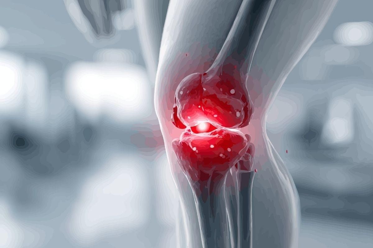 Infiltração para tendinite no joelho: opções seguras e eficazes