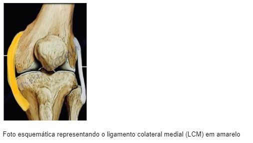 3 Formas de Fortalecer o Ligamento Colateral Medial (LCM)