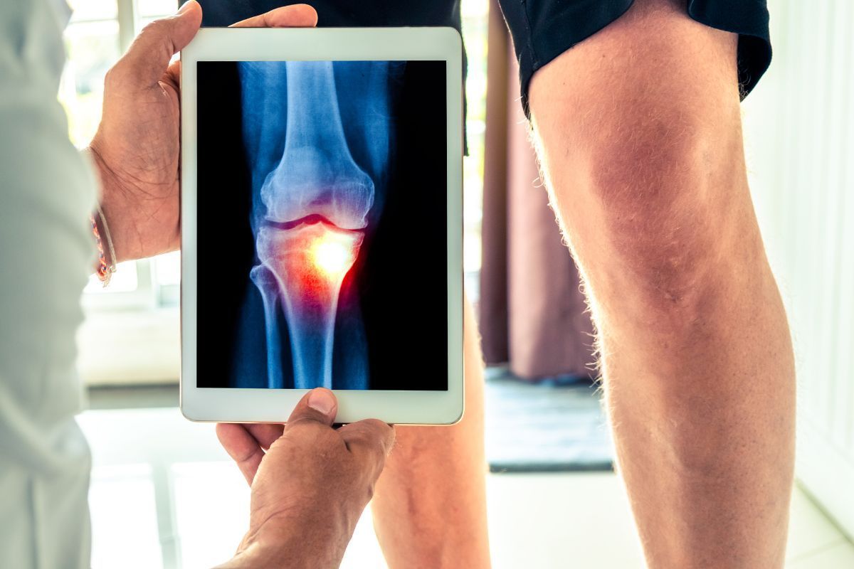 Cirurgia de prótese de joelho em São Paulo: saiba o momento certo de fazer!