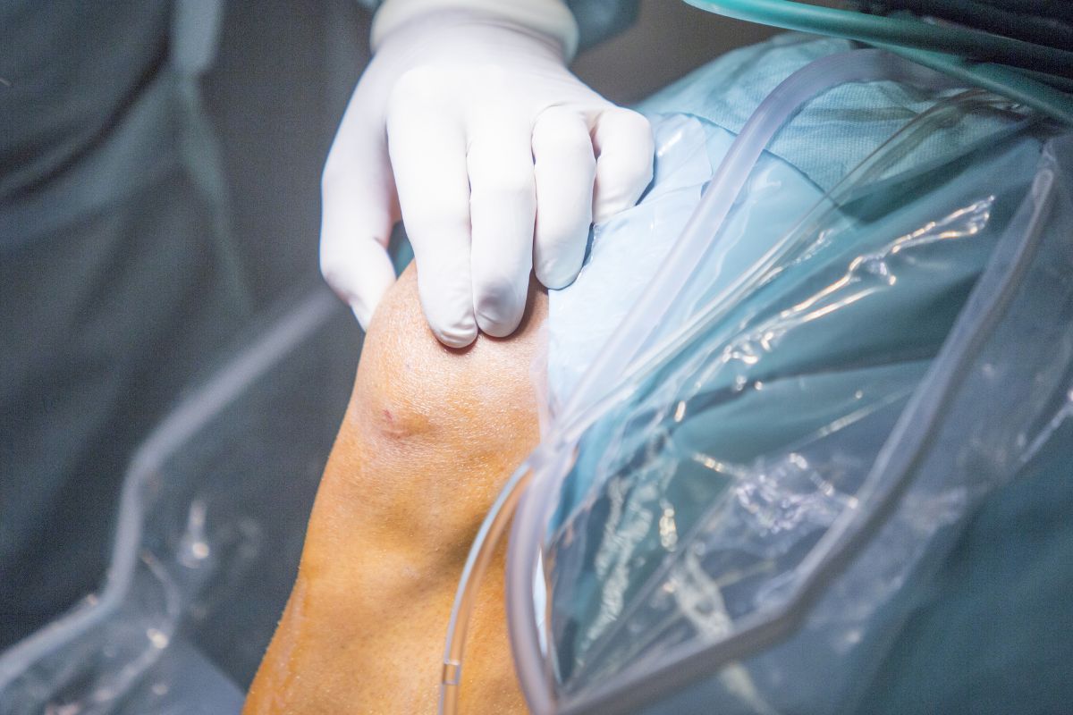 Transplante osteocondral: entenda o procedimento e os cuidados no pós-operatório