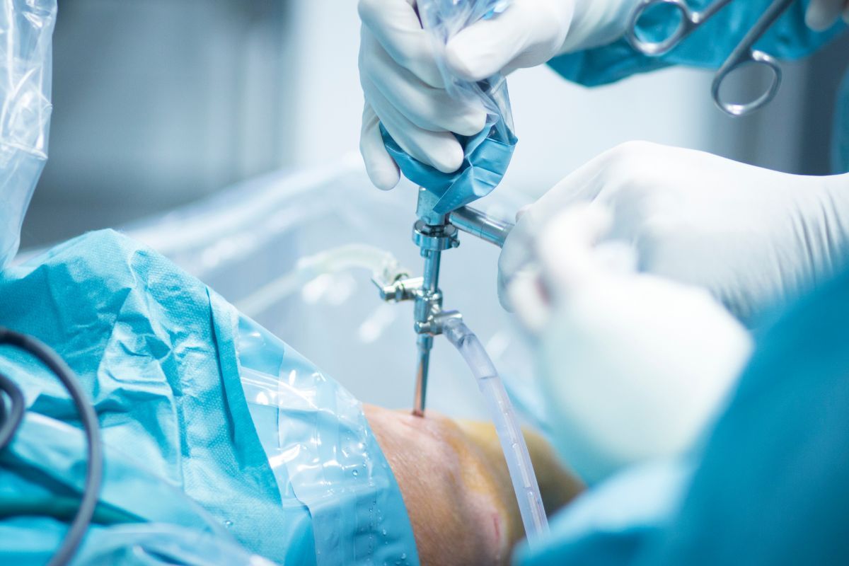 tratamento-lesao-osteocondral-joelho-dr-diego-munhoz-ortopedista-joelho-sao-paulo