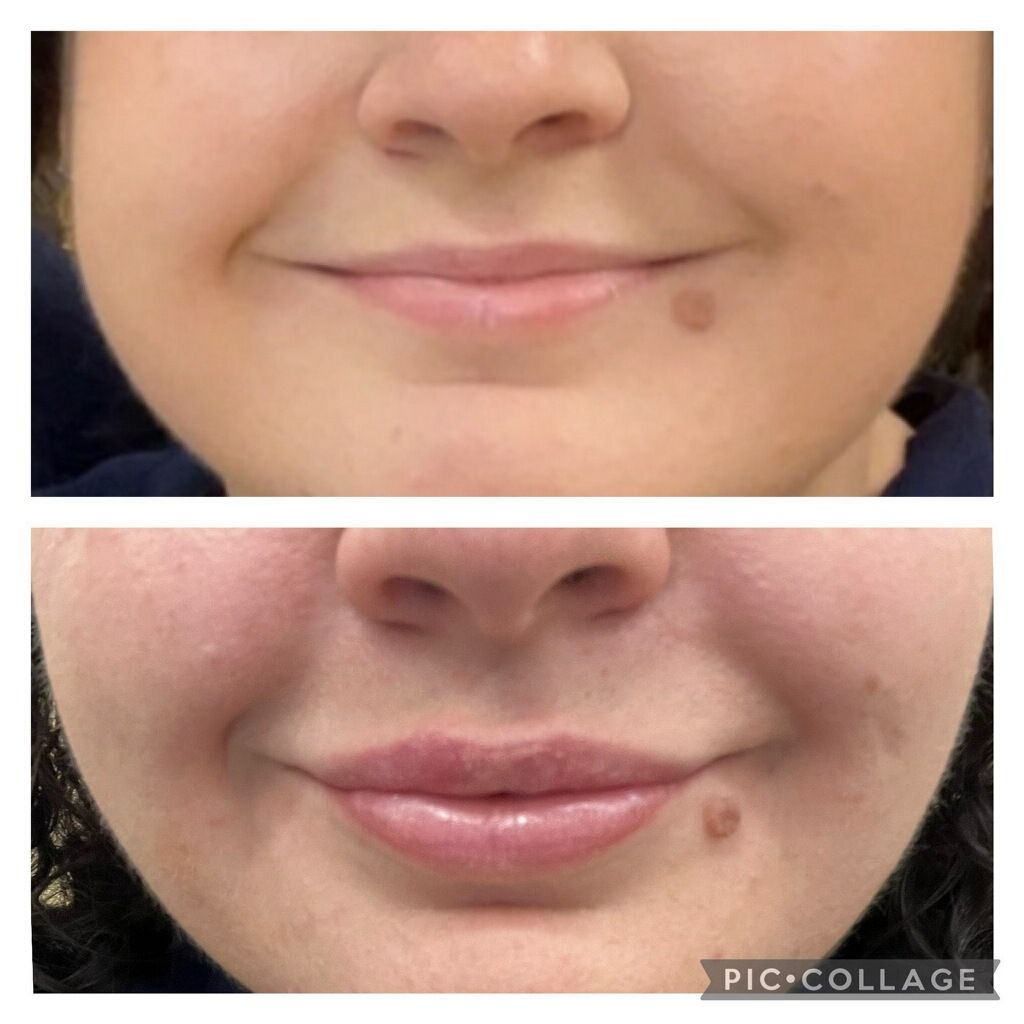 A before and after photo of a woman 's face