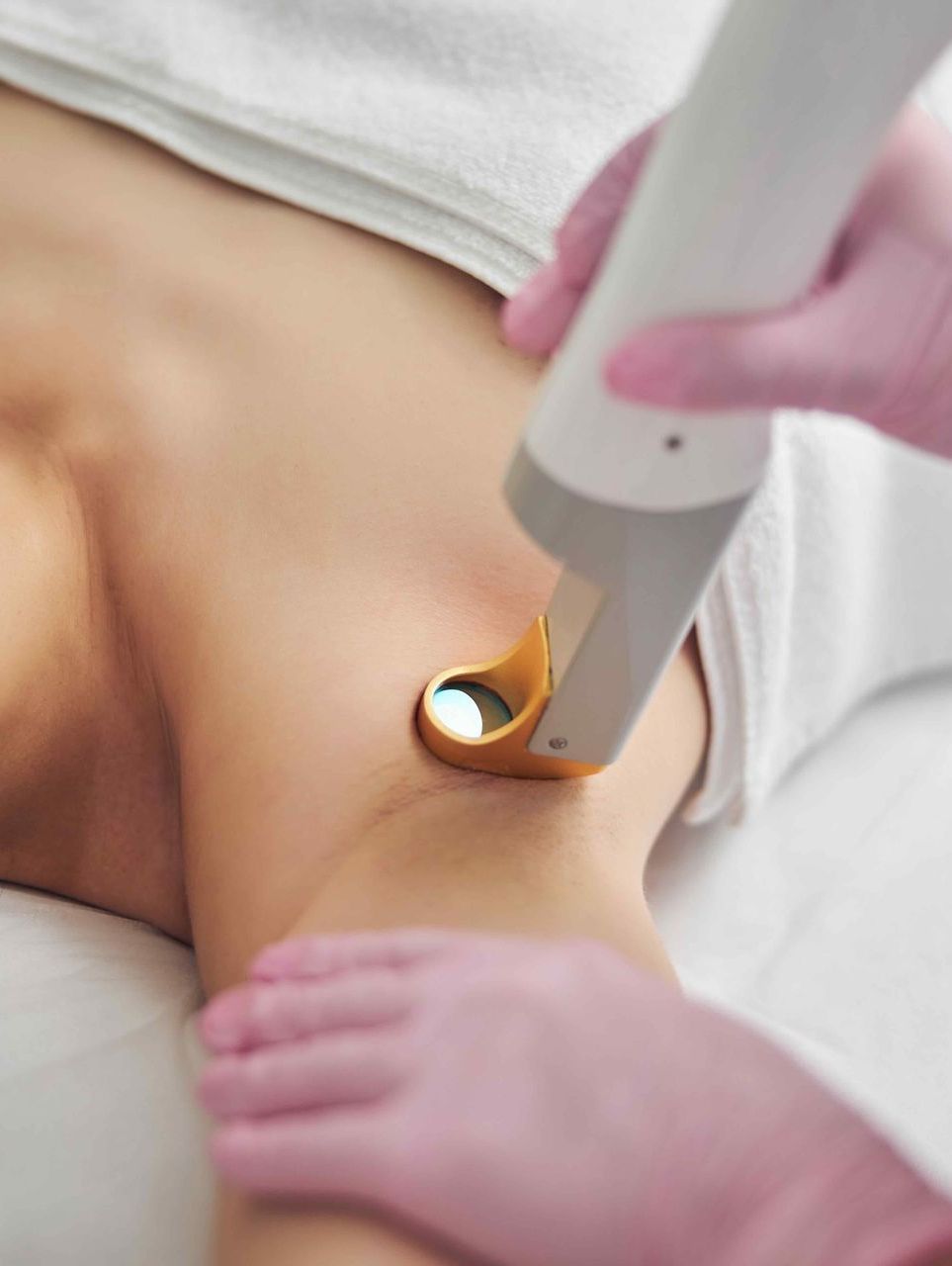 a woman is getting a laser treatment on her underarm .